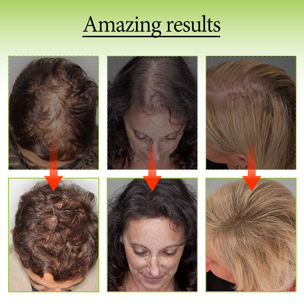 HAIR GROWTH SERUM SPRAY