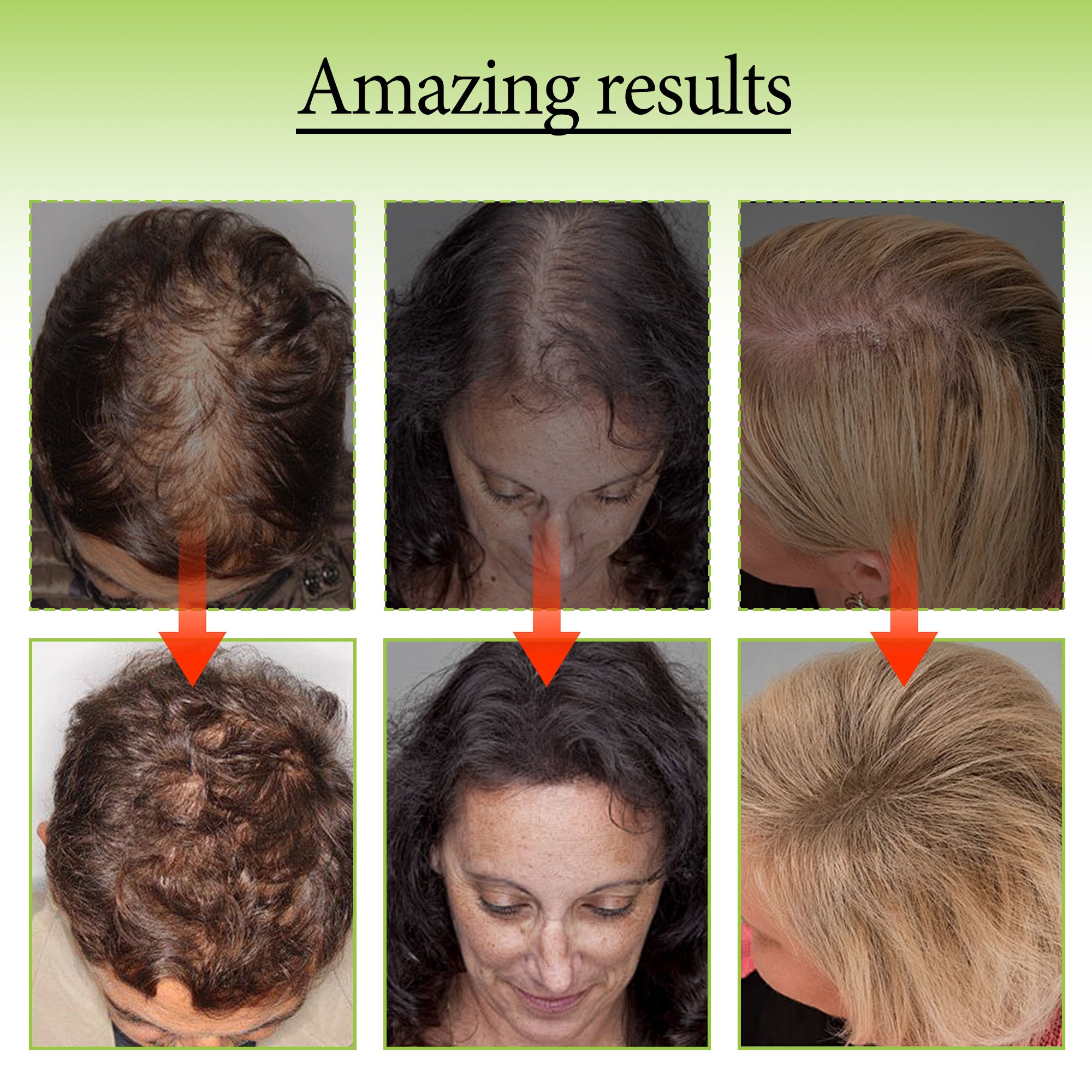 HAIR GROWTH SERUM SPRAY